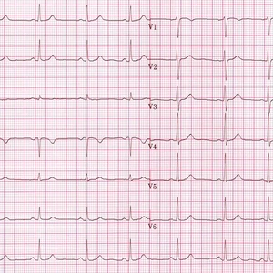 EKG doučovanie pre študentov