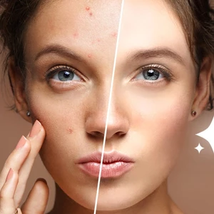 Retuš fotky - odstranění nedokonalostí