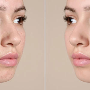 Udělám retuš fotky, bělení zubů, odstranění červených očí, ořez pozadí nebo jeho výměnu